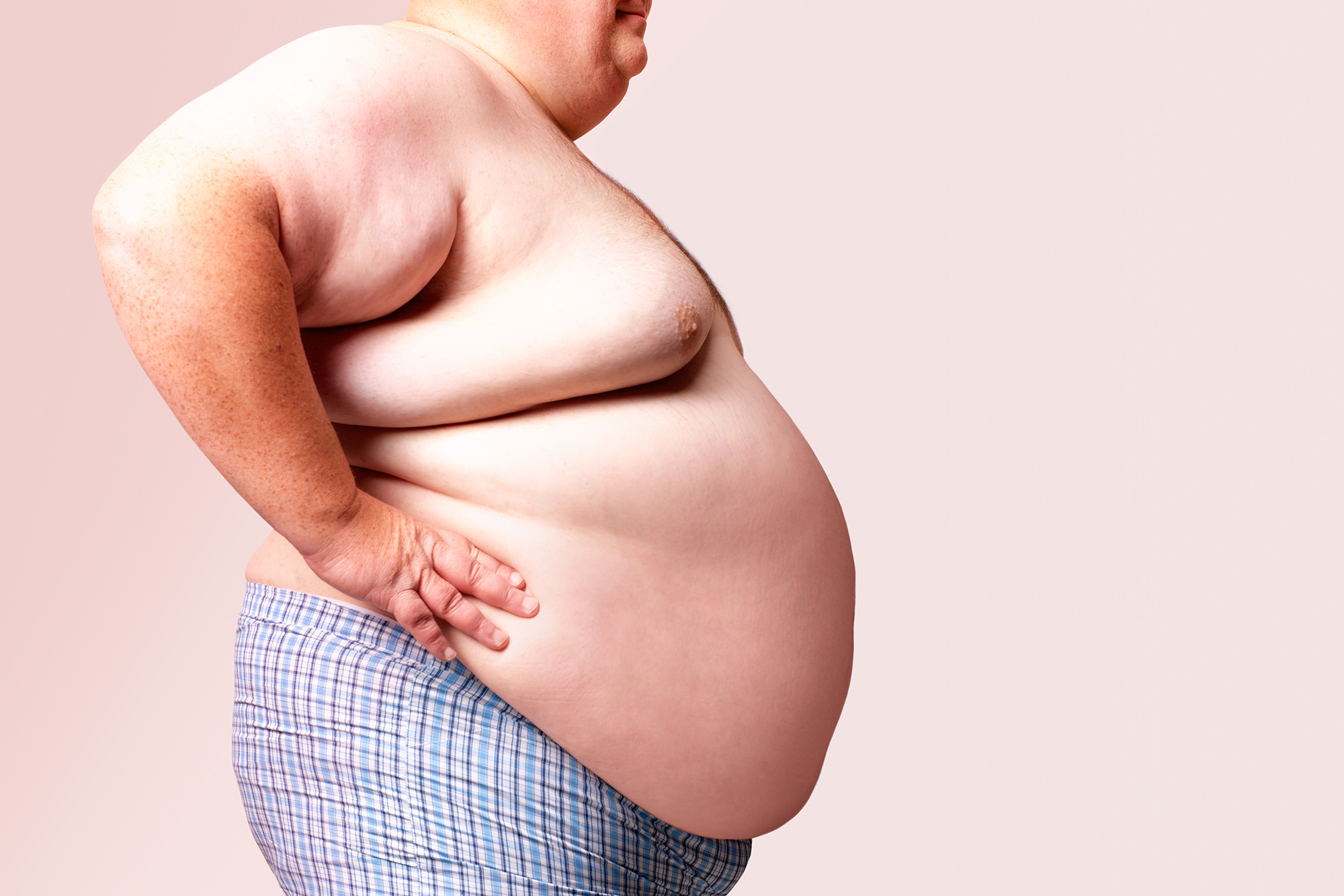 Empower Your Health Journey: Primecare’s Expert Homecare for Obesity